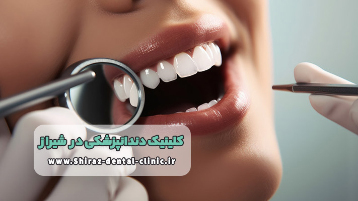 معرفی بهترین کلینیک دندانپزشکی شیراز