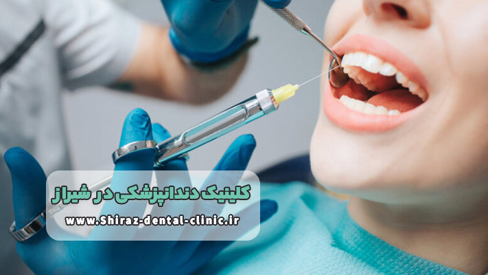 هزینه مواد و تجهیزات در کلینیک دندانپزشکی شیراز